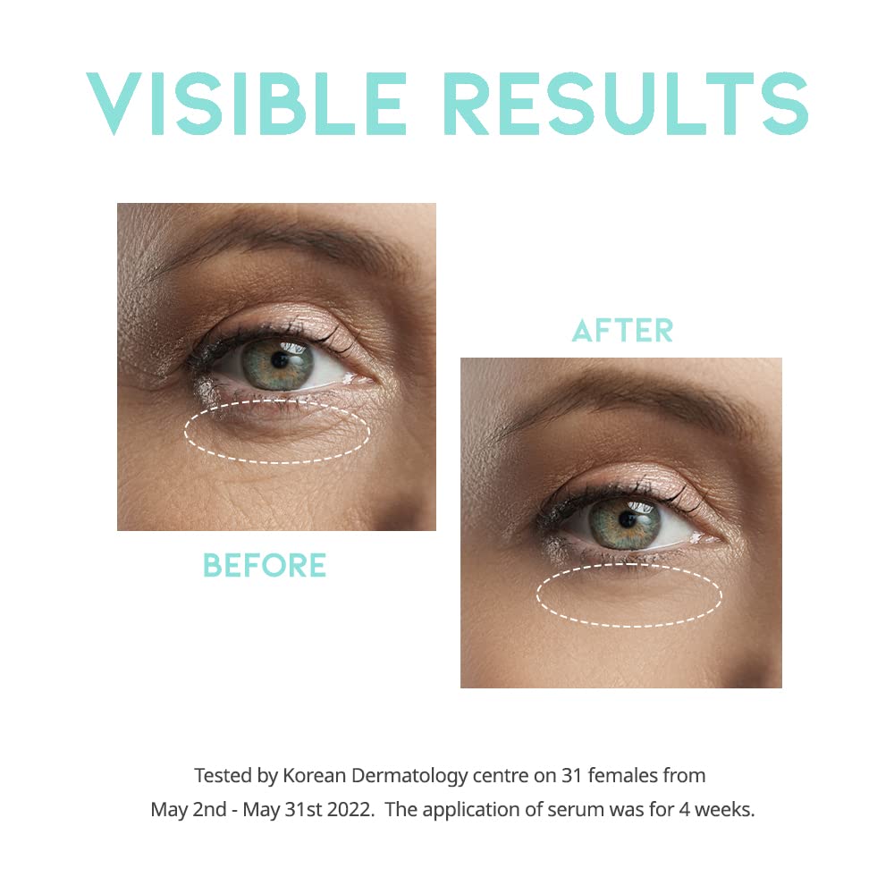 Retinol Eye Cream Serum For Wrinkle Lift, Anti Aging, Under Eye Bag, Puffy Eyes and Dark Circles Treatment, Ceramide, Hyaluronate, Korean Vegan Eye Facial Serum 30g