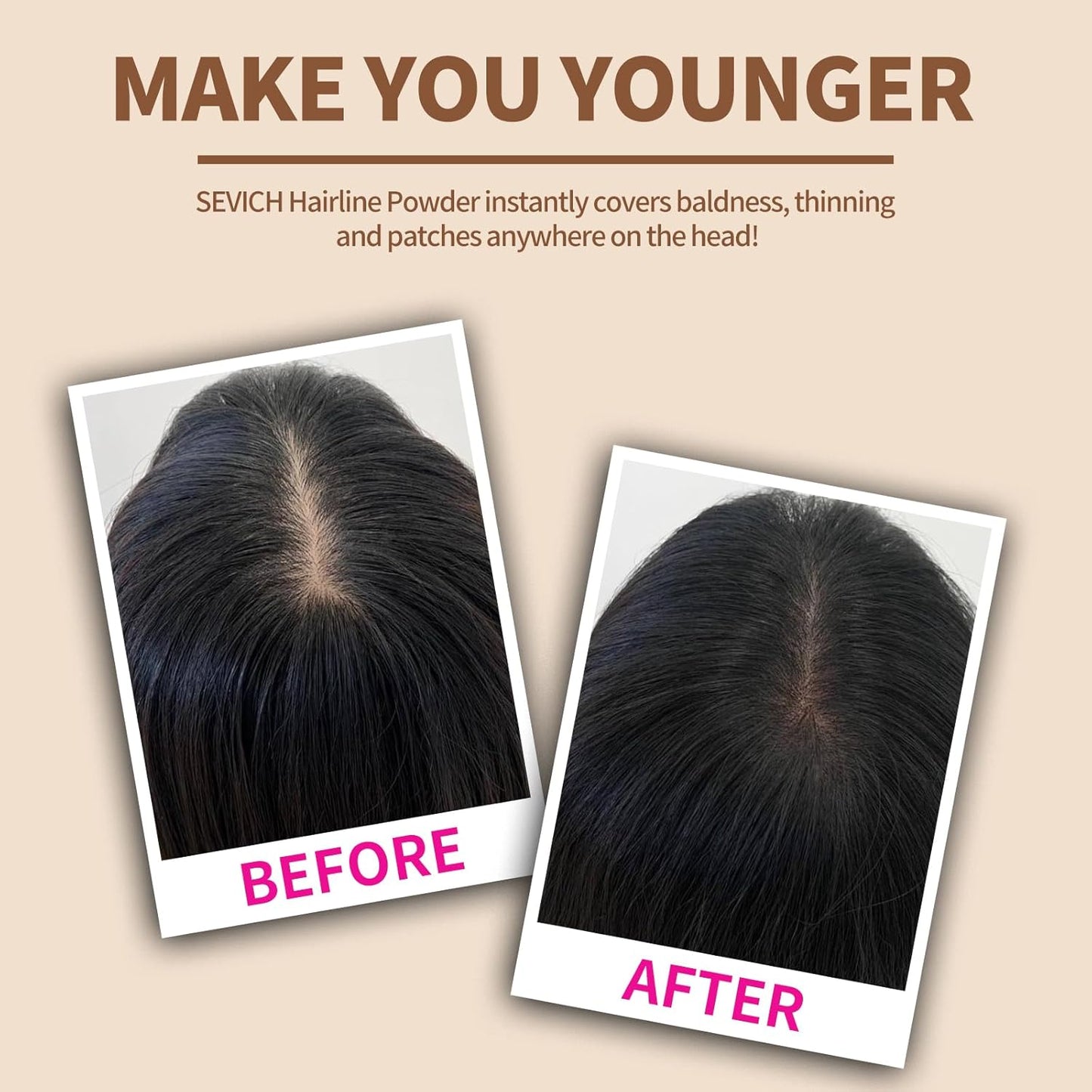 Instantly SEVICH Hairline Powder - Quick Cover Grey Hair Concealer for Thinning Hairlines, Eyebrows & Beards, Windproof & Sweatproof, Med Blonde