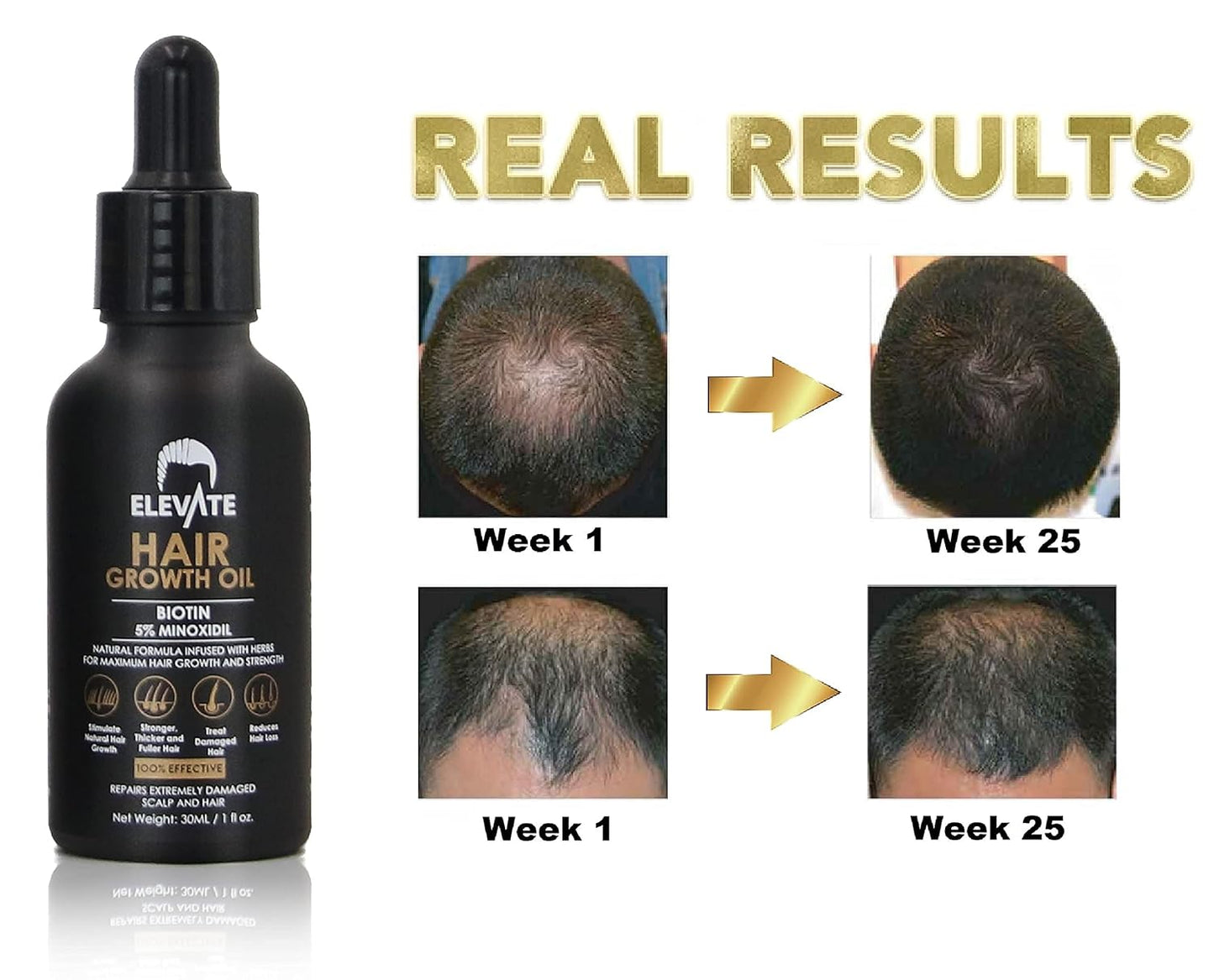 ELEVATE Hair Growth Oil - Biotin Serum & 5% Minoxidil Treatment for Stronger Thicker Longer Hair – Natural Hair Growth Thickening Treatment - Stop Thinning & Hair Loss for Men & Women 1oz