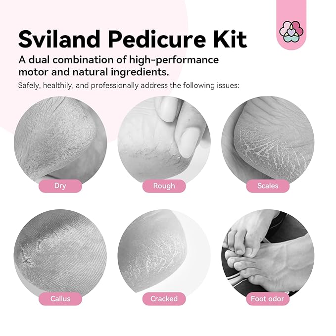 SAVILAND 2024 Electric Feet Callus Remover with Ultra-Repair Foot Cream 120 g: Rechargeable Portable Electric Callus Remover for Feet Professional Pedicure Care Kit for Cracked Dead Skin