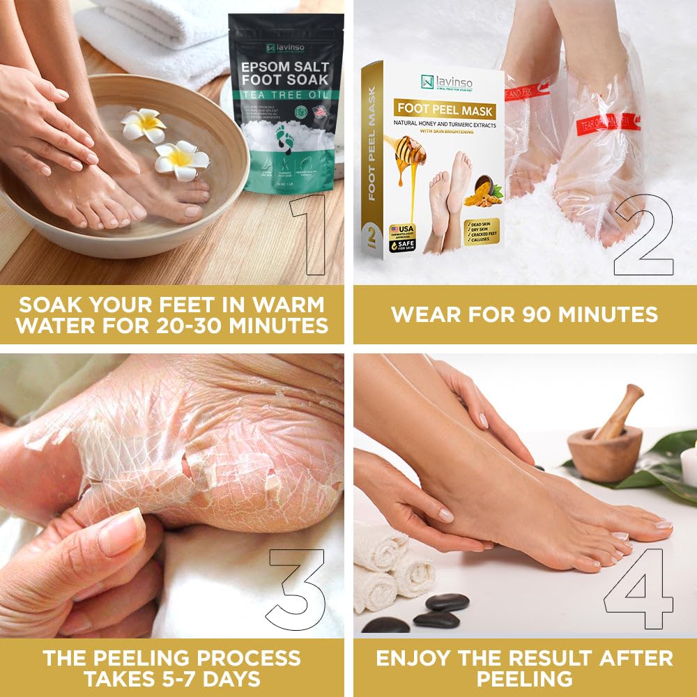 Lavinso Honey Feet Peeling Mask for Dry Cracked Feet - 3 Pack - with Kojic Acid Skin Brightening Effect - Exfoliating Dead Skin and Calluses - Foot Peel Mask for Baby Soft Feet
