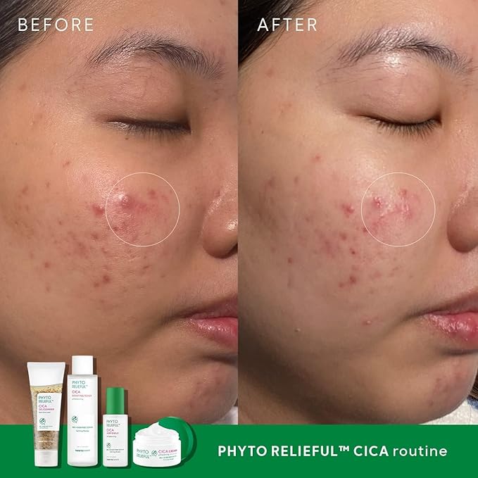 THANKYOU FARMER Phyto Relieful CICA PHA LHA Boosting Toner 7.03 fl oz (200ml), Dermatologist Tested, Alcohol-Free Liquid Exfoliant for Face, Oil-Free Hydrating Toner, Vegan, Fragrance-Free