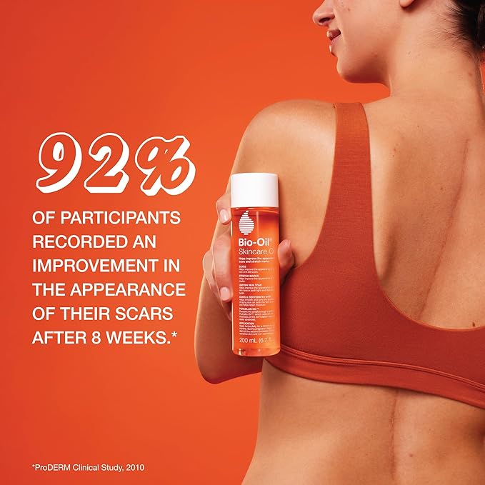 Bio-Oil Skincare Body Oil Serum, Face and Body Moisturizer with Vitamin E & A, for Scars, Stretch Marks, Sensitive Skin, All Skin Types, Dermatologist Recommended, Non-Comedogenic, 2 Oz